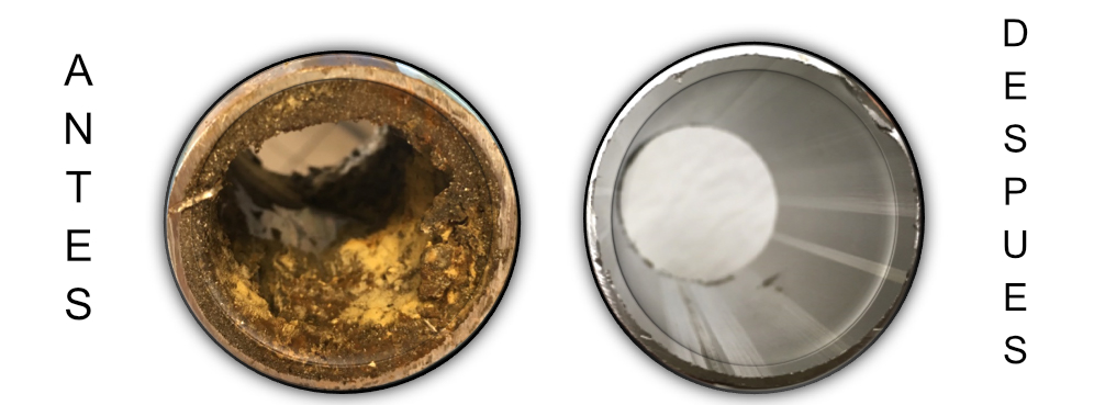 Actu detartrage 2 es Actu detartrage 2 es